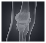 Knee Injury Image