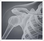 Shoulder Injury Image